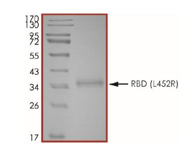 The purity of 2019-nCoV Spike protein S1 subunit, RBD (L452R) was determined to be >90% by densitometry